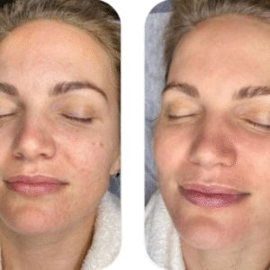 2d283dba-ff8c-4f97-aecf-f89bcda92d7e-edited-free (carve.photos)