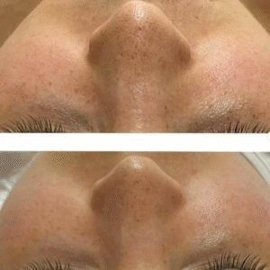 5168243711892522877-edited-free (carve.photos)