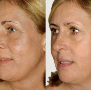 5168243711892522878-edited-free (carve.photos)