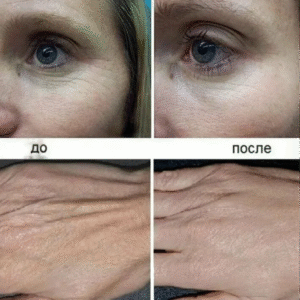 5168243711892522879-edited-free (carve.photos)