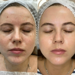 5168243711892522881-edited-free (carve.photos)