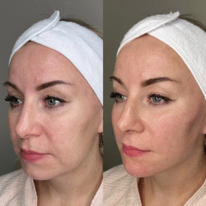 5168243711892522882-edited-free (carve.photos)