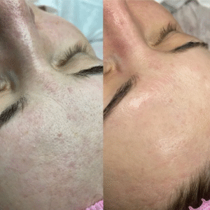 5168243711892522884-edited-free (carve.photos)