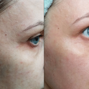 5168243711892522885-edited-free (carve.photos)