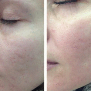 5168243711892522886-edited-free (carve.photos)