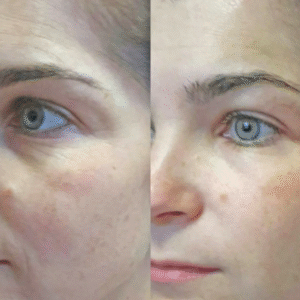 5168243711892522887-edited-free (carve.photos)